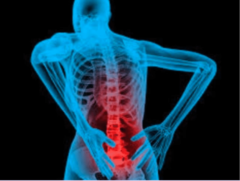 5 Secrets to a Healthy Spine